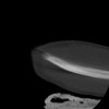 SPORK, NICO - 22.03.1976 - 02.08.2022 - CT obere Extremität - 17:59:38